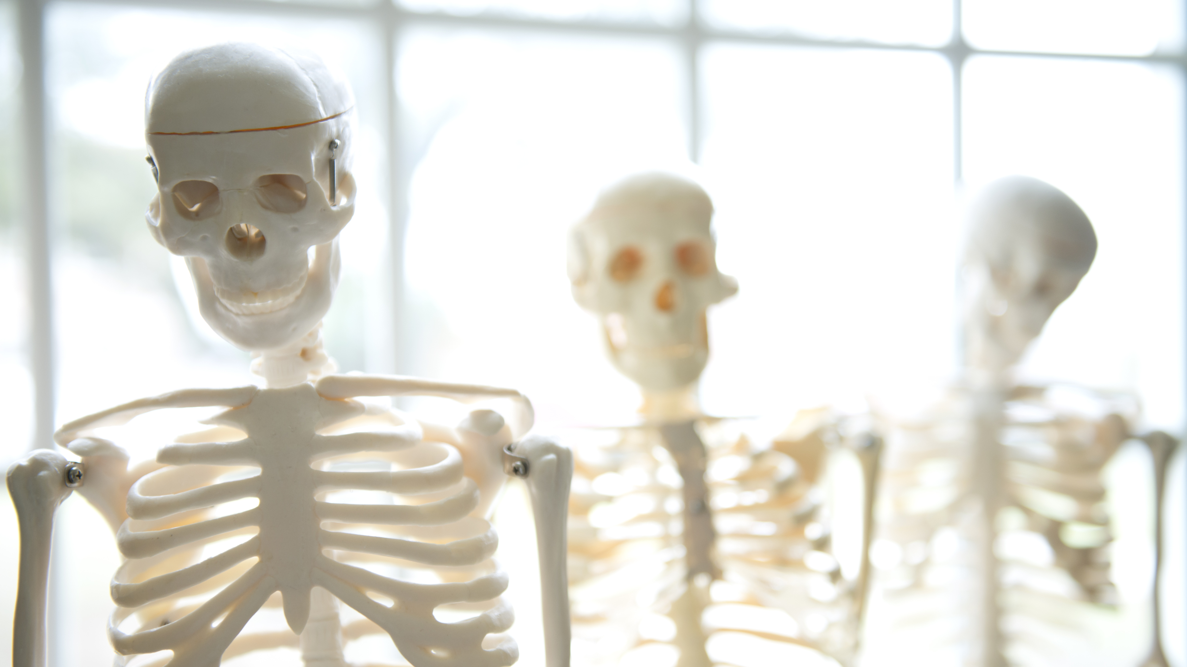 Skeletal Replicas, Ice Buckets
