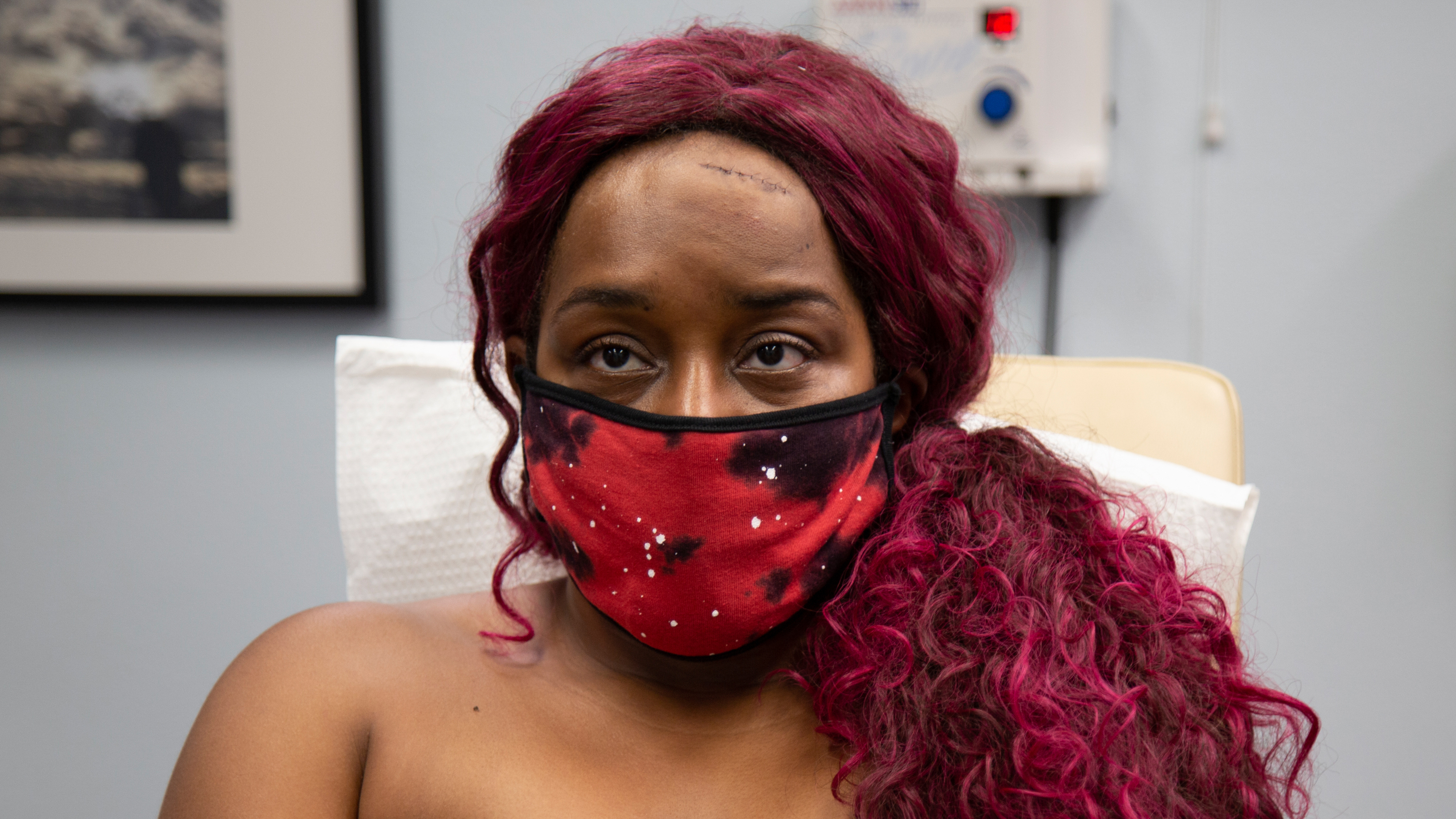 Pop Ups: Cyst Pits